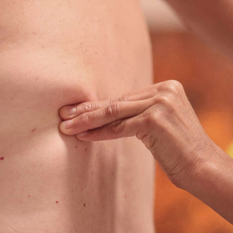 Bindegewebsmassage im Rückenbereich